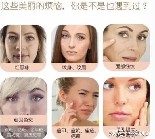 激光祛斑真害人？深度解析激光祛斑的利與弊，深度解析，激光祛斑的利弊與潛在風(fēng)險揭秘