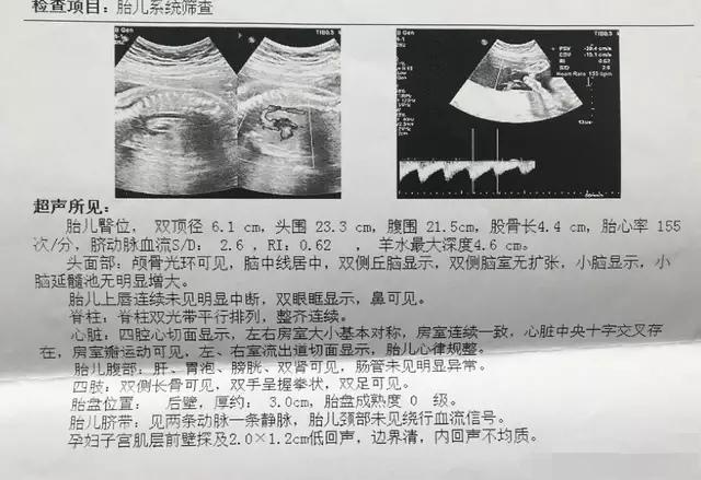 殲-11B重型戰(zhàn)斗機(jī)，卓越性能與先進(jìn)技術(shù)的完美結(jié)合，殲-11B重型戰(zhàn)斗機(jī)，卓越性能與技術(shù)的巔峰融合