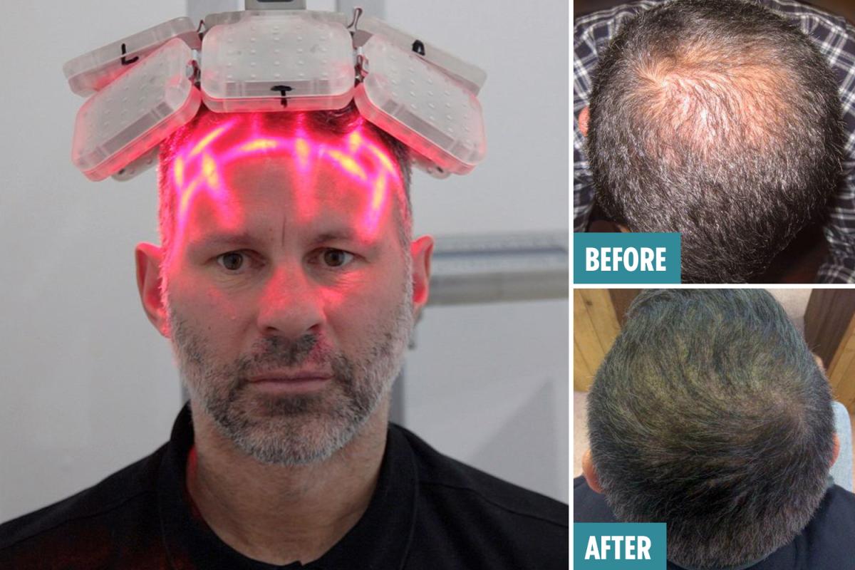 激光手術(shù)費(fèi)用詳解，多少錢(qián)一次？，激光手術(shù)費(fèi)用全面解析，手術(shù)費(fèi)用究竟是多少？