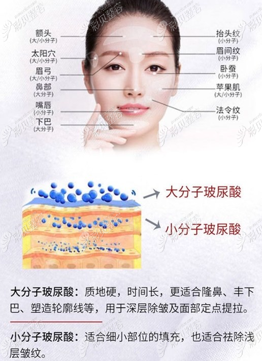 玻尿酸的作用與功效，深入了解玻尿酸的奧秘，玻尿酸的作用與功效揭秘，深入了解玻尿酸的神奇之處