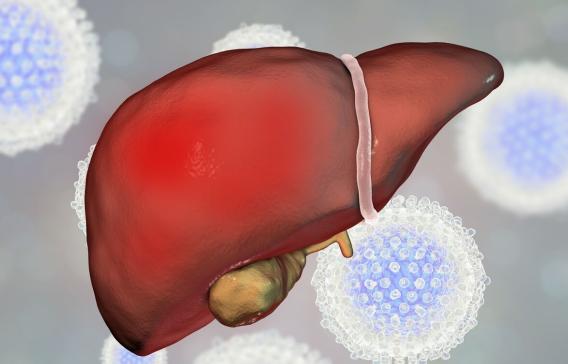 肝硬化的癥狀及表現(xiàn)，肝硬化的癥狀與表現(xiàn)概述