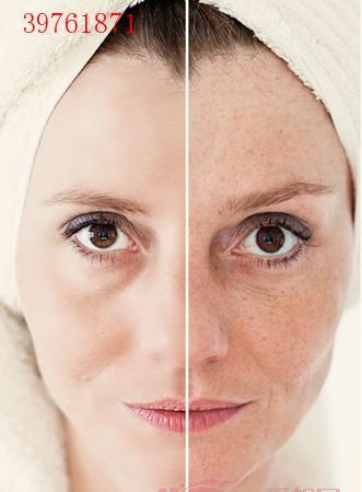 曬斑如何淡化或去掉——美白肌膚的秘訣，曬斑淡化與去除方法，美白肌膚的秘訣